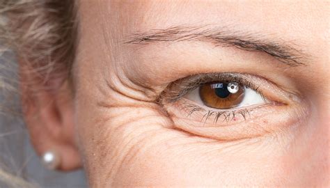 Wrinkles As Related To Aging Skin Pictures