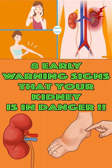 8 Warning Symptoms Of Kidney Damage Kidney Damage Health Health And