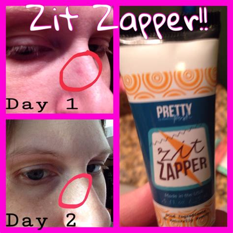 Zit Zapper Stop Those Pimples In Their Tracks Zits Pimples Bottle
