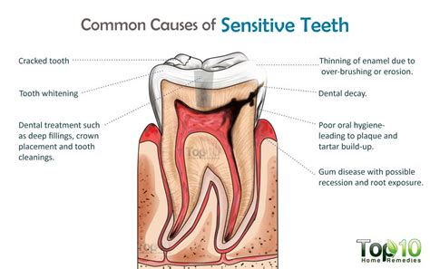 how to relieve tooth sensitivity home remedies and tips top 10 home remedies