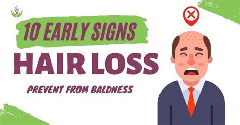 10 Early Signs Of Hair Loss Can Help You Prevent Baldness
