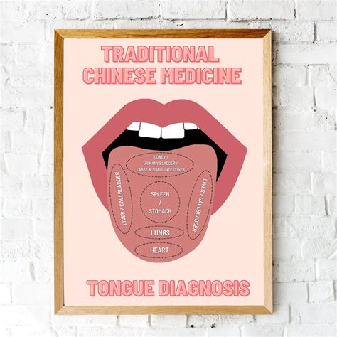 Tcm Study Guide Traditional Chinese Medicine Tongue Etsy