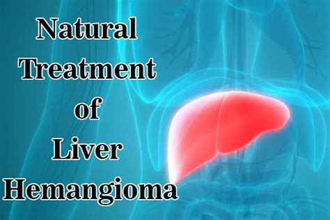 Natural Treatment Of Liver Hemangioma
