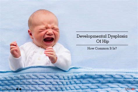 Developmental Dysplasia Of Hip How Common It Is By Dr Ravi C V