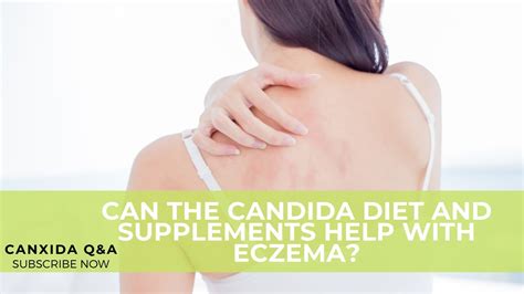 Can The Candida Diet And Supplements Help With Eczema Customer