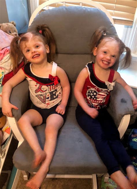 Delaney Twins Conjoined Twins Return Home After Successful Separation