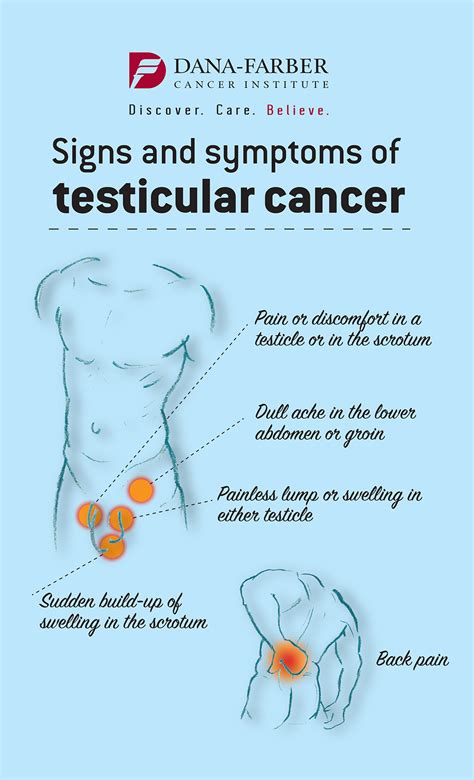 Testicular Cancer Stages