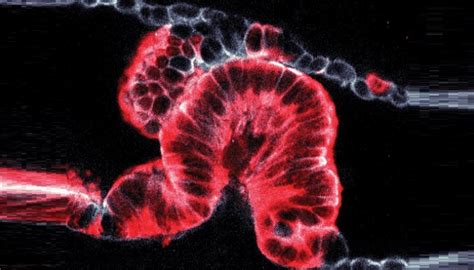 May 12, 2021 · pancreatic cancer develops when uncontrolled cell growth begins in a part of the pancreas. تصوير ثلاثي الأبعاد لسرطان البنكرياس يكشف لغز تشكل الأورام