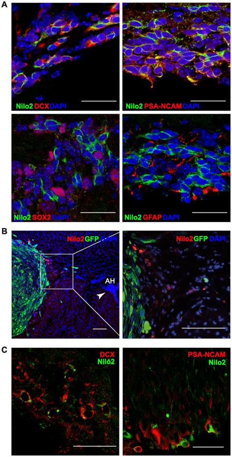 Immunohistochemistry Of Subventricular Zone Fixed Brain Sections