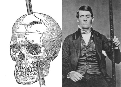 The Curious Case Of Phineas Gage Doctors Impossible