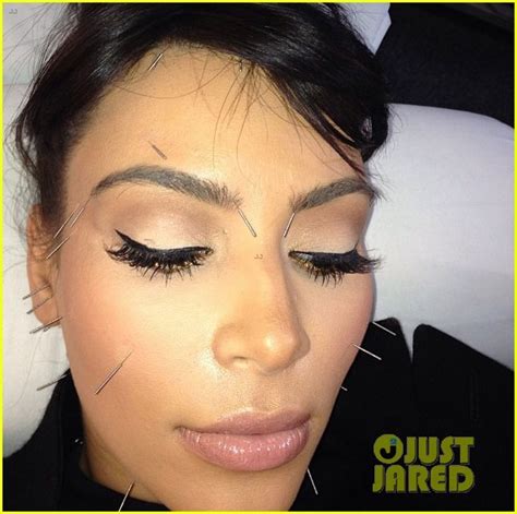 Pregnant Kim Kardashian Shows Off Acupuncture Face Photo 2837854 Kim