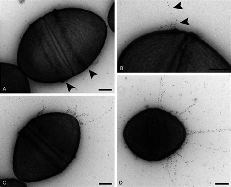 Tem Micrographs Of Pilb Type Pili Expression In Different Phases Of
