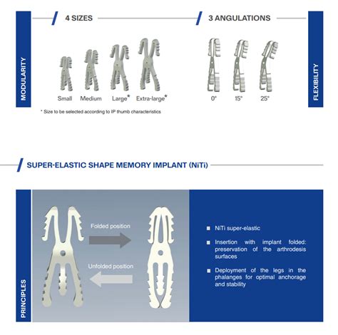 Kerifuse® Intramedullary Arthrodesis Implant Dip Ip