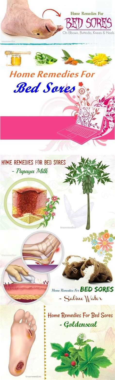 16 Home Remedies For Bed Sores On Elbows Buttocks Knees And Heels Bed