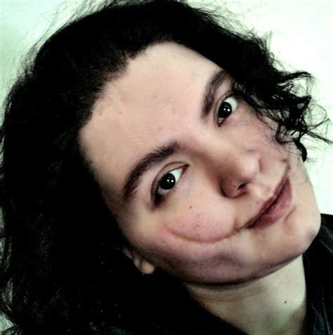 Also known as a chelsea smile. Jeff the Killer / WMG - TV Tropes