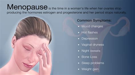 Menopause Symptoms Shown Using Medical Animation Still Shot