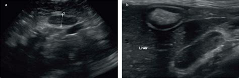 Feline Abdominal Ultrasonography Whats Normal Whats Abnormal The