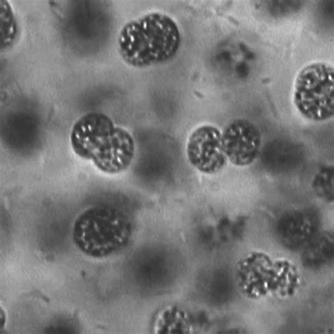 Microcystis Aeruginosa Dividing Cells Of Samples From Grangent