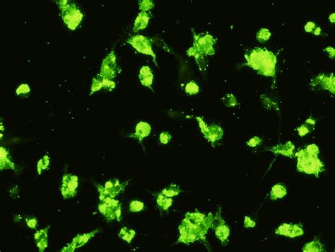 Scimedx Ifa Bacterial Assays — Scimedx Corporation