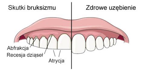 BRUKSIZM NANO DENT Gabinet Stomatologiczny Dentysta Świdnica