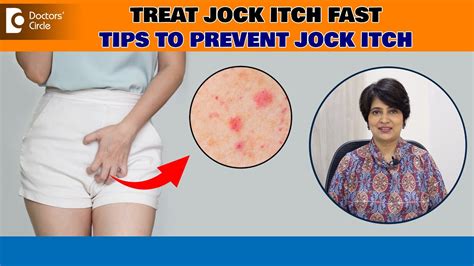 Jock Itch Tinea Cruris Best Ways To Avoid Itching Down There Dr