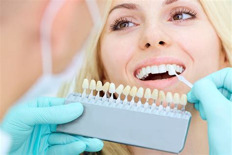 Visit Your Dentist Newport Beach To Get The Best Advice About Veneers