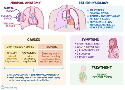 Pathophysiology Of Pneumothorax Thorax Lung Images And Photos Finder