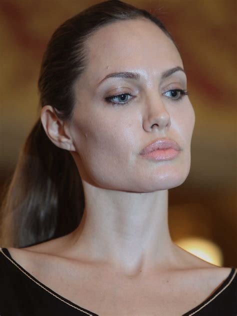 Angelina Jolie S Mastectomy Decision And Weighing Cancer Risks Shots Health News Npr