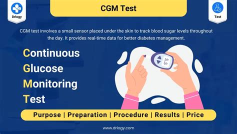Continuous Glucose Monitoring Cgm Test For Diabetes Drlogy