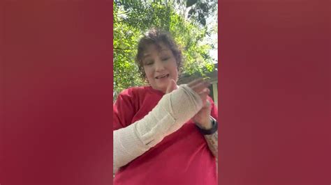 Day 6 Post Op Carpal And Cubital Tunnel Release Surgery Youtube