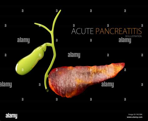 Healthy Pancreas High Resolution Stock Photography And Images Alamy