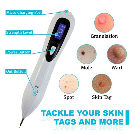 Electronic Skin Tag Remover Skin Tags Removal Pen Beauty Etsy Canada
