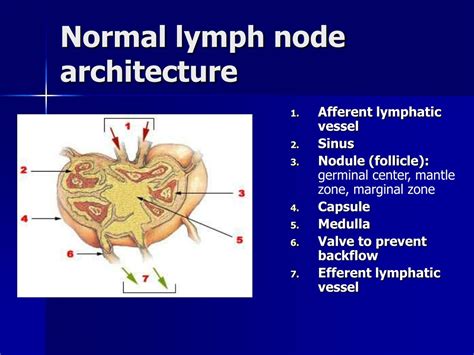 Ppt Lymphoma Non Hodgkin Lymphoma Hodgkin Lymphoma Hodgkin