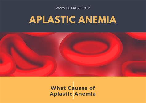 What Is Aplastic Anemia What Causes Of Aplastic Anemia Niazi Tv