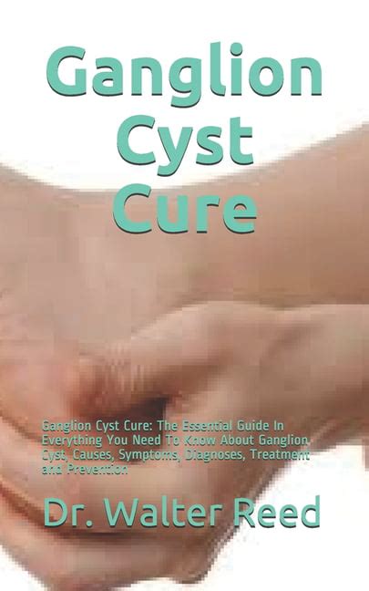 Ganglion Cyst Cure Ganglion Cyst Cure The Essential Guide In