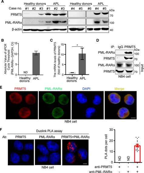 Prmt5 Is Highly Expressed In Apl Cells And Interacts With Pml Rarα A