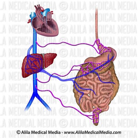 Alila Medical Media Collaterals In Portal Hypertension Medical