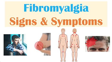 Fibromyalgia Signs And Symptoms Associated Conditions Youtube