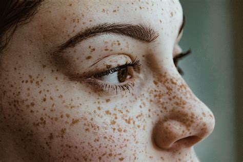 Although most people only get pimples and acne during their teen years; How to Prevent and Treat Pimples After a Wax