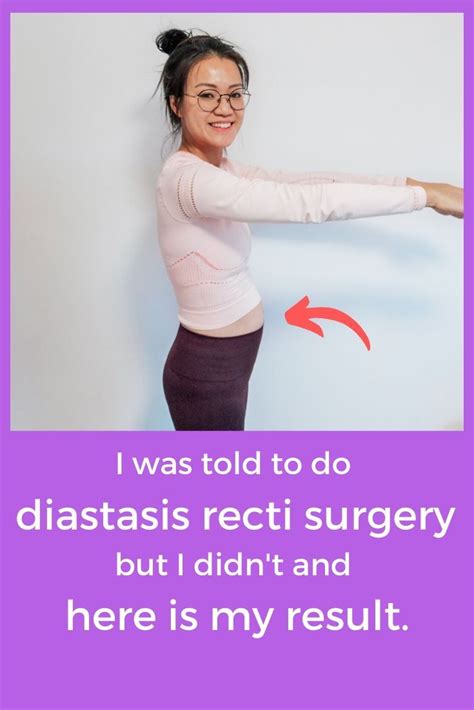 Access hollywood, la times, star, la mag, us mag, elle, cnbc, intouch diastasis recti surgery aka tummy tuck sounds daunting to me. The thought of the surgery itself ...