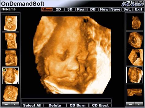 We did not find results for: ultrasound 3d | Ultrasound technician, Mums the word ...