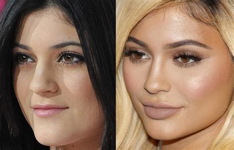 Top 25 Celebrities Before And After Plastic Surgery And ...