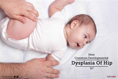 How Common Developmental Dysplasia Of Hip Is Treated By Dr Ravi C V