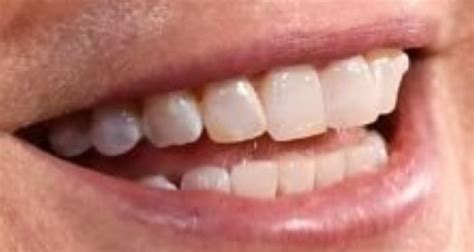 Gwyneth Paltrow Teeth Pictures