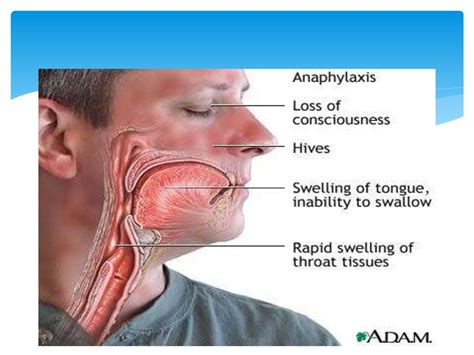 Anatomy Of Larynx And Trachea