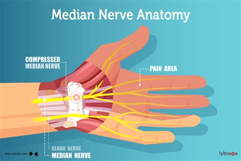 Carpal Tunnel Syndrome Compressed Median Nerve Anatomy Of The Carpal Tunnel Showing The Median