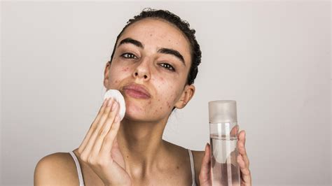 A Daily Skincare Routine For Oily Acne Prone Skin Minimalist