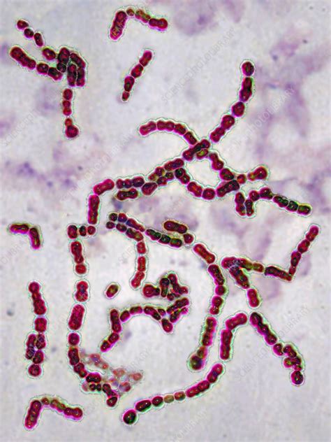 Streptococcus Pyogenes Stock Image C0214500 Science Photo Library