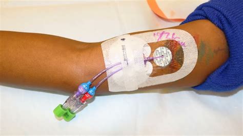 Iv Infusion Picc Line