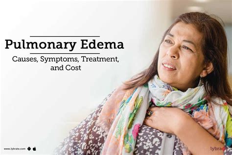 Pulmonary Edema Symptom Causes Treatment And Prevention